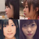 指原って整形したの? 指原って整形したの?