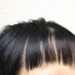 【悲報画像】セルフカットした俺薄毛24歳の前髪wwwwwwwwwww 【悲報画像】セルフカットした俺薄毛24歳の前髪wwwwwwwwwww