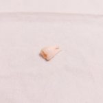 現役アイドルの抜歯された「歯」をご覧ください・・・ 現役アイドルの抜歯された「歯」をご覧ください・・・