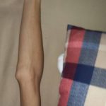 【悲報】ワイの腕、細すぎてさすがに気持ち悪い・・・ 【悲報】ワイの腕、細すぎてさすがに気持ち悪い・・・