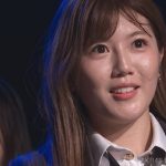 【画像】みゃおこと宮崎美穂cの顔に謎の丸い跡が・・・ 【画像】みゃおこと宮崎美穂cの顔に謎の丸い跡が・・・