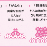 癌「数年以内に殺すぞ、末期は地獄の苦しみ与えるぞ」 癌「数年以内に殺すぞ、末期は地獄の苦しみ与えるぞ」