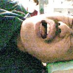 【画像】クロちゃん、大腸に腫瘍性ポリープ判明「死にたくない」切除手術へ・・・ 【画像】クロちゃん、大腸に腫瘍性ポリープ判明「死にたくない」切除手術へ・・・